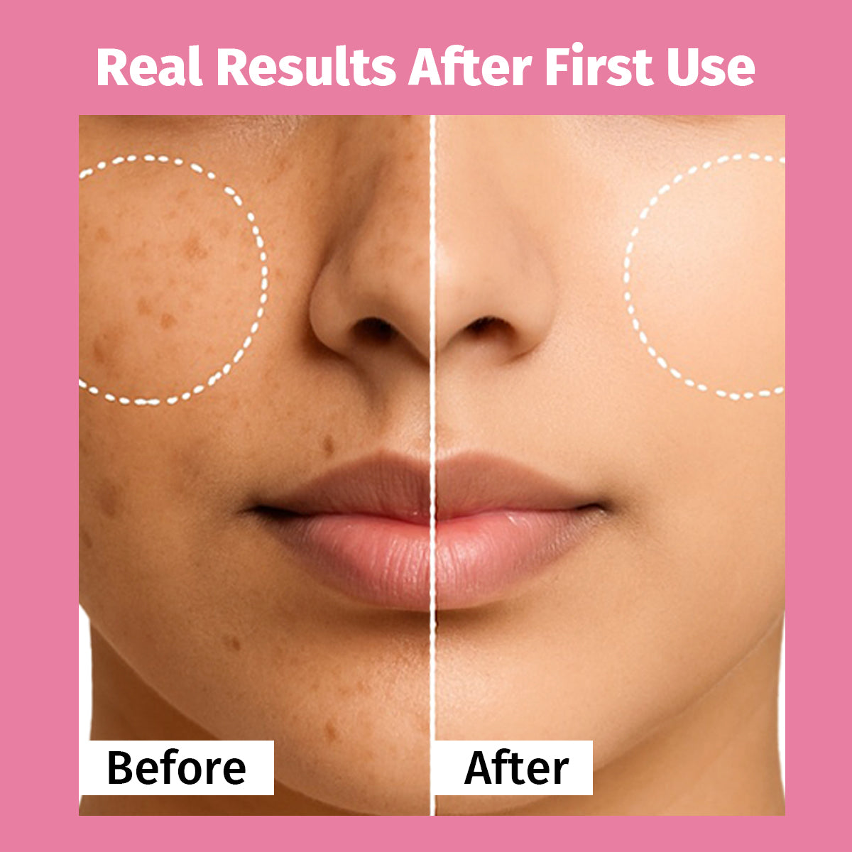 Pure Origin Korean Vitamin C Brightening Facial Kit